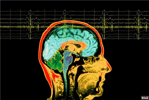 英国玩家玩游戏时犯癫痫 大洋彼岸好友出手相救 联机游戏 光敏性癫痫 游戏警告 电玩迷资讯  第3张